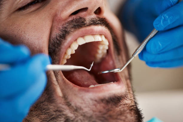 Best Chipped Tooth Repair Near Me  in Richlands, VA